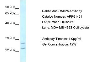 Western Blotting (WB) image for anti-RAB2A, Member RAS Oncogene Family (RAB2A) (C-Term) antibody (ABIN786423) (RAB2A antibody  (C-Term))