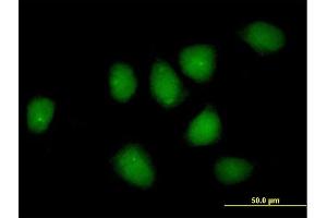 Immunofluorescence of purified MaxPab rabbit antibody to NR3C1 on HeLa cell. (Glucocorticoid Receptor antibody  (AA 1-777))
