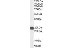 ABIN184625 (0. (BAG2 antibody  (C-Term))