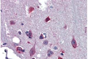 Immunohistochemistry (Paraffin-embedded Sections) (IHC (p)) image for anti-Nuclear Receptor Subfamily 2, Group E, Member 1 (NR2E1) (AA 95-144) antibody (ABIN6741553)