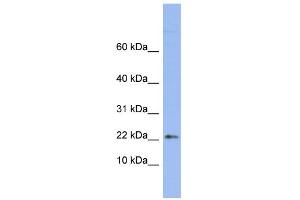 WB Suggested Anti-RPS24 Antibody Titration:  0. (RPS24 antibody  (Middle Region))