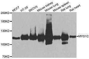 Western blot analysis of extracts of various cell lines, using MYO1C antibody. (Myosin IC antibody  (AA 769-1028))