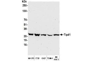 Western Blotting (WB) image for anti-TIP41-like protein (TIPRL) (C-Term) antibody (ABIN7453900)