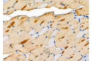 ABIN6257114 and ABIN6274151 at 1/100 staining Rat skin tissue by IHC-P. (CKM antibody  (N-Term))