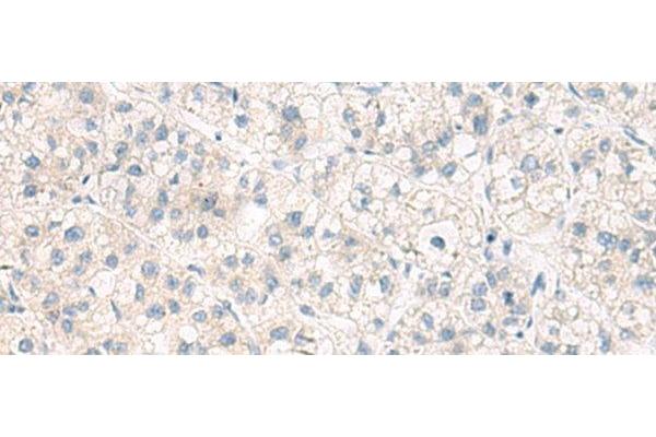 ANKS6 antibody