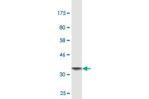 Western Blot detection against Immunogen (37. (ALPL antibody  (AA 91-200))