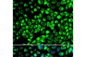 Immunofluorescence analysis of HeLa cells using ATP6AP2 Polyclonal Antibody (ATP6AP2 antibody)