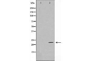 Western blot analysis on HeLa cell lysate using EFNA2 Antibody,The lane on the left is treated with the antigen-specific peptide. (Ephrin A2 antibody  (N-Term))