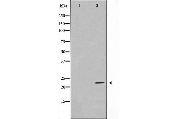 Ephrin A2 antibody  (N-Term)