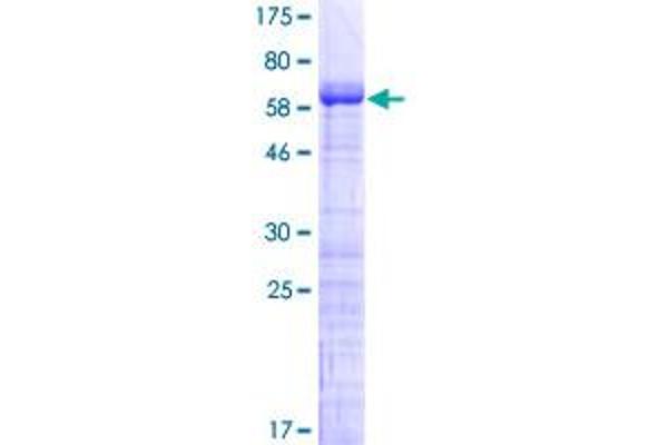 MAGEB2 Protein (AA 1-319) (GST tag)