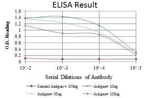 Red: Control Antigen (100 ng), Purple: Antigen (10 ng), Green: Antigen (50 ng), Blue: Antigen (100 ng), (GRK2 antibody)