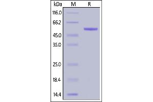 Rhesus macaque Complement Factor D, Fc Tag on  under reducing (R) condition.