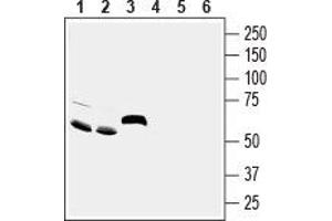 Western blot analysis of rat brain (lanes 1 and 4), mouse brain (lanes 2 and 5) and rat small intestine (lanes 3 and 6) lysates: - 1-3. (ACCN5 antibody  (Extracellular Loop))