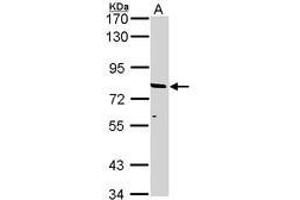 Image no. 2 for anti-ATP-Binding Cassette, Sub-Family D (ALD), Member 2 (Abcd2) (AA 338-558) antibody (ABIN467567) (Abcd2 antibody  (AA 338-558))