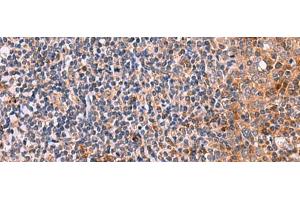 Immunohistochemistry of paraffin-embedded Human tonsil tissue using KLK9 Polyclonal Antibody at dilution of 1:50(x200) (Kallikrein 9 antibody)