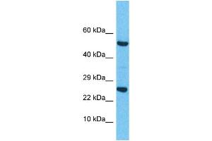 Western Blotting (WB) image for anti-Related RAS Viral (R-Ras) Oncogene Homolog 2 (RRAS2) (C-Term) antibody (ABIN2785767) (RRAS2 antibody  (C-Term))