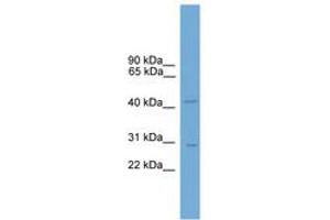 Image no. 1 for anti-Mastermind-Like 2 (MAML2) (AA 169-218) antibody (ABIN6744662) (MAML2 antibody  (AA 169-218))