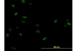 Immunofluorescence of monoclonal antibody to POLA2 on HeLa cell. (POLA2 antibody  (AA 1-598))