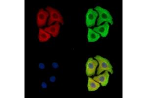 ABIN7097063 and ABIN7101130 staining Hela cells by IF/ICC. (FAM161B antibody)