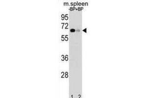 Western Blotting (WB) image for anti-Ankyrin Repeat and SOCS Box-Containing 3 (ASB3) antibody (ABIN2998967)