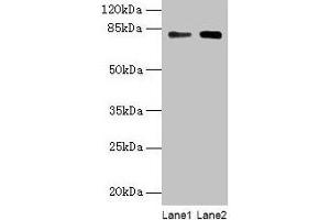 Western blot All lanes: MASP1 antibody at 6 μg/mL Lane 1: Hela whole cell lysate Lane 2: U251 whole cell lysate Secondary Goat polyclonal to rabbit IgG at 1/10000 dilution Predicted band size: 80, 82, 44, 69 kDa Observed band size: 80 kDa (MASP1 antibody  (AA 20-699))