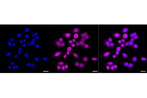 Immunocytochemical staining of HepG2 cells with Eukaryotic translation elongation factor 2 antibody (ABIN7798502), 1:1,000).