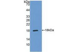 Western blot analysis of recombinant Human IL5Ra. (IL5RA antibody  (AA 42-182))