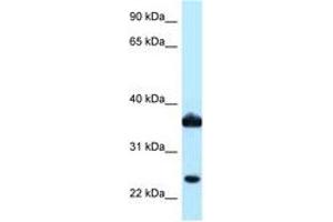 Image no. 1 for anti-Aldo-Keto Reductase Family 1, Member C3 (3-alpha Hydroxysteroid Dehydrogenase, Type II) (AKR1C3) (AA 97-146) antibody (ABIN6747883) (AKR1C3 antibody  (AA 97-146))
