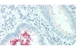 Immunohistochemistry of paraffin-embedded Human Uterus tissue using SLC34A2 Polyclonal Antibody at dilution of 1:60.