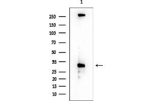 Western blot analysis of lysates from EC304 cells, using HDAC8 Antibody at 1/1000 dilution.