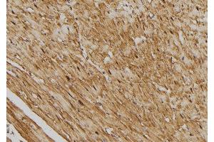 ABIN6275415 at 1/100 staining Rat heart tissue by IHC-P. (SSH3 antibody  (Internal Region))