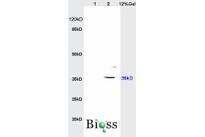 L1 rat brain lysates L2 human colon carcinoma lysates probed with Anti IGFBP2 Polyclonal Antibody, Unconjugated (ABIN737781) at 1:200 overnight at 4 °C.