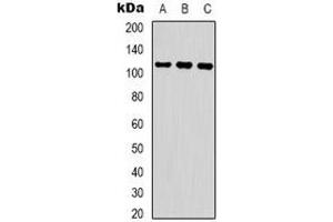 Western blot analysis of COP1 (pS387) expression in Jurkat UV-treated (A), 293 UV-treated (B), K562 UV-treated (C) whole cell lysates.