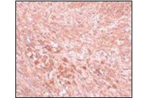 Immunohistochemistry of LZTR2 in mouse kidney tissue with this product at 5 μg/ml.