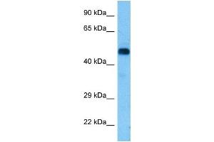 Host:  Rat  Target Name:  RIPK3  Sample Tissue:  Rat Brain  Antibody Dilution:  1ug/ml (RIPK3 antibody  (Middle Region))