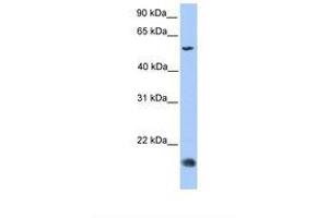 Image no. 1 for anti-CKLF-Like MARVEL Transmembrane Domain Containing 8 (CMTM8) (C-Term) antibody (ABIN6739410) (CMTM8 antibody  (C-Term))