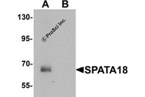 Western Blotting (WB) image for anti-Spermatogenesis Associated 18 (SPATA18) (N-Term) antibody (ABIN1031583) (SPATA18 antibody  (N-Term))