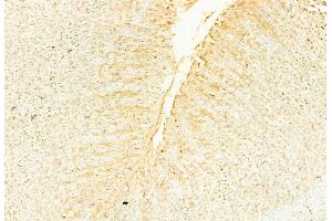ABIN6266354 and ABIN6276702 at 1/100 staining Rat stomach tissue by IHC-P. (NQO1 antibody  (C-Term))