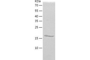 Protein Phosphatase 1, Regulatory (Inhibitor) Subunit 2 (PPP1R2) (AA 1-166) protein (His-IF2DI Tag)