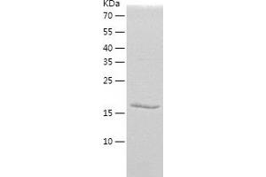 Western Blotting (WB) image for Protein Phosphatase 1, Regulatory (Inhibitor) Subunit 2 (PPP1R2) (AA 1-166) protein (His tag) (ABIN7286123) (PPP1R2 Protein (AA 1-166) (His tag))