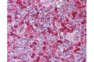 Immunohistochemistry (IHC) image for anti-Spleen tyrosine Kinase (SYK) (AA 5-360) antibody (ABIN2665374) (SYK antibody  (AA 5-360))