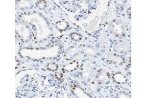 ABIN6266711 at 1/100 staining human kidney tissue sections by IHC-P. (AKAP8 antibody  (Internal Region))