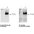 anti-Epidermal Growth Factor Receptor (EGFR) (C-Term) antibody