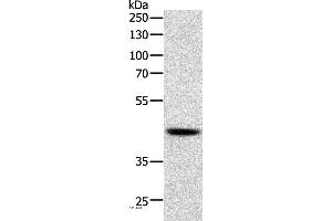 Western blot analysis of Human lymphoma tissue, using SOX7 Polyclonal Antibody at dilution of 1:750