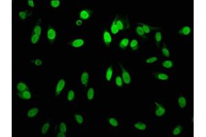 Immunofluorescence staining of Hela cells with ABIN7127304 at 1:60,counter-stained with DAPI. (Recombinant HIST1H3A antibody  (H3R2me))