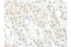 anti-Protein Phosphatase 2, Regulatory Subunit B', gamma (PPP2R5C) (AA 490-524) antibody
