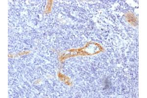 Formalin-fixed, paraffin-embedded human Tonsil stained with vWF Recombinant Mouse Monoclonal Antibody (rVWF/1465). (Recombinant VWF antibody  (AA 1815-1939))