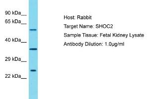 Host: Rabbit Target Name: SHOC2 Sample Tissue: Human Fetal Kidney Antibody Dilution: 1ug/ml (SHoc2/Sur8 antibody  (N-Term))