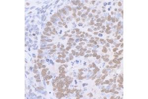 Immunohistochemistry (IHC) image for anti-Sp1 Transcription Factor (SP1) (C-Term) antibody (ABIN7458075) (SP1 antibody  (C-Term))