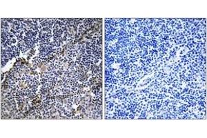 Immunohistochemistry analysis of paraffin-embedded human thymus gland tissue, using Collagen XIX alpha1 Antibody.